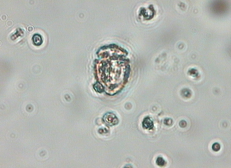 Dictyocha speculum
